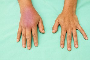 How Are Soft Tissue Injuries Diagnosed?